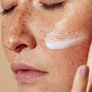 Close Up Of Female Face With Freckled Skin. High Detailed Shot Of Woman Skin Applying Moisturizer.